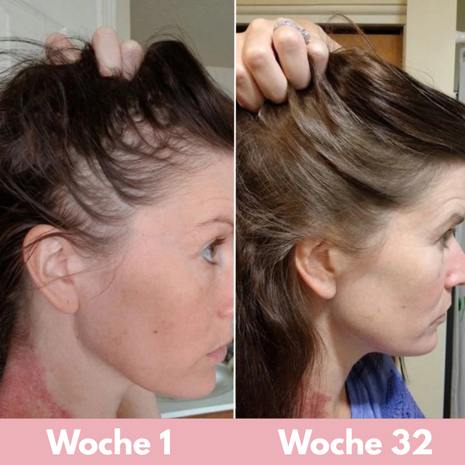 Das 3 Step Aveloira System